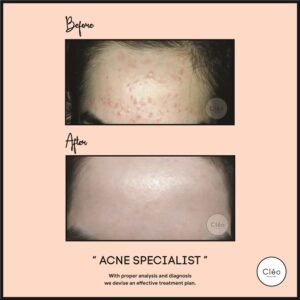 Skin Diseases