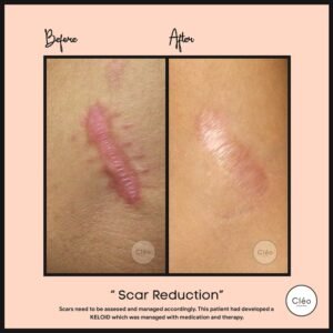 Skin Diseases