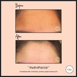 Cosmetic Dermatology