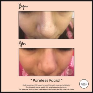 Skin Diseases
