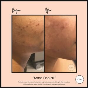 Skin Diseases