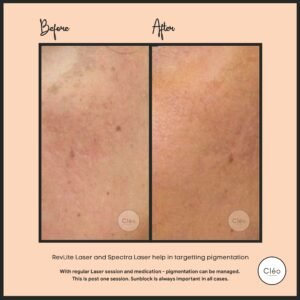 Skin Diseases