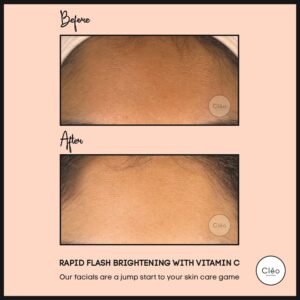 Cosmetic Dermatology