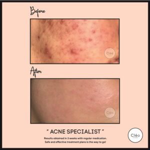 Skin Diseases