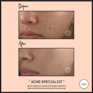 Cosmetic Dermatology