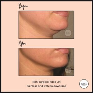 Cosmetic Dermatology