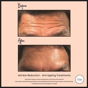 Skin Diseases