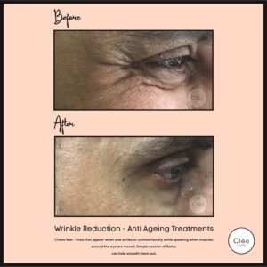 Cosmetic Dermatology