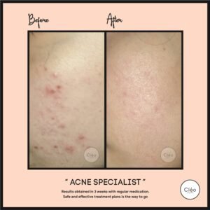 Skin Diseases