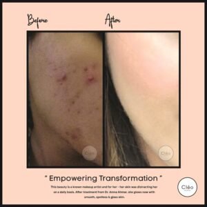 Skin Diseases