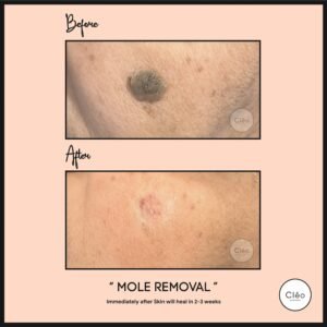 Medical Dermatology