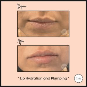 Cosmetic Dermatology