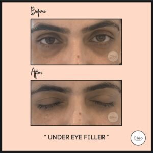 Cosmetic Dermatology