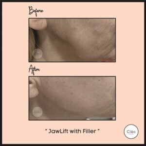 Cosmetic Dermatology