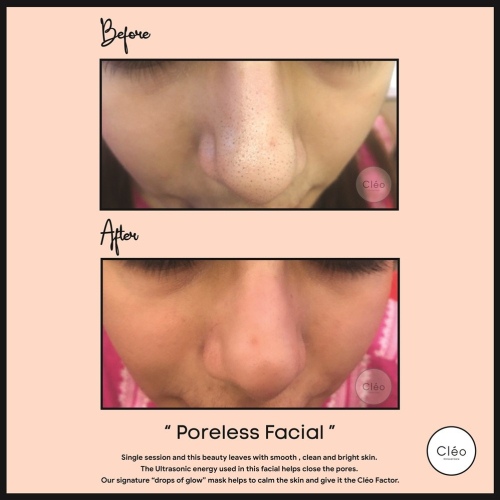 poreless facial