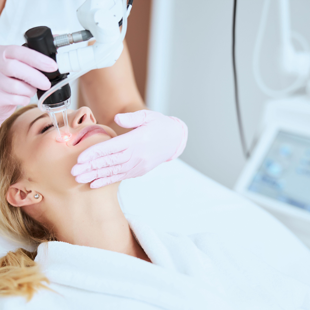 Fractional CO2 Laser.