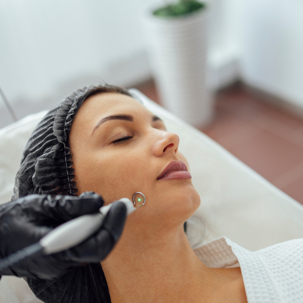 Micro Dermabrasion
